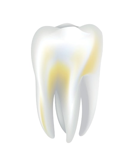 Zubný kameň